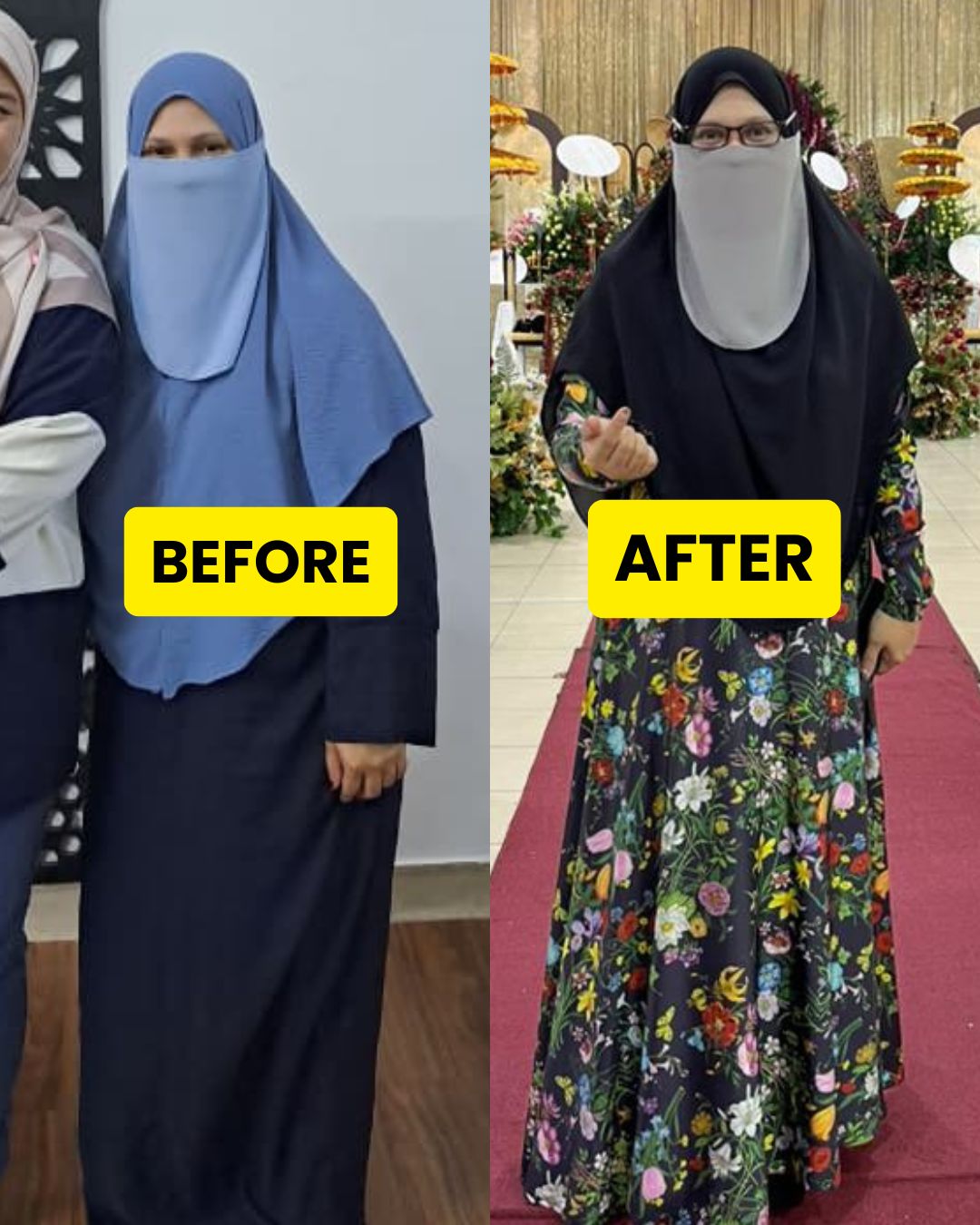 Before After 1