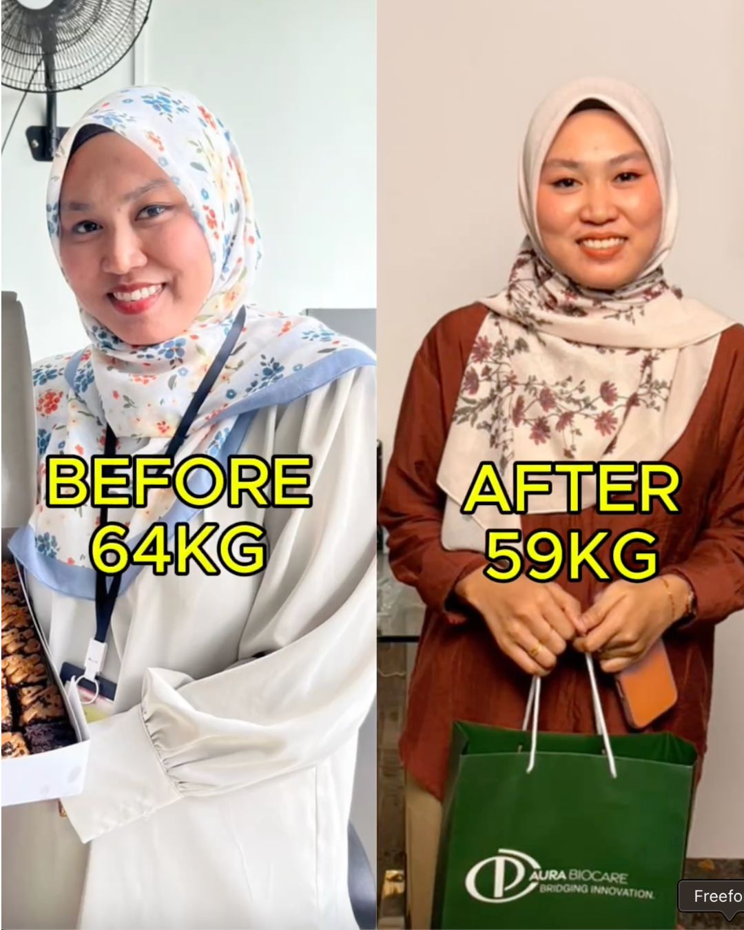 Before After 3