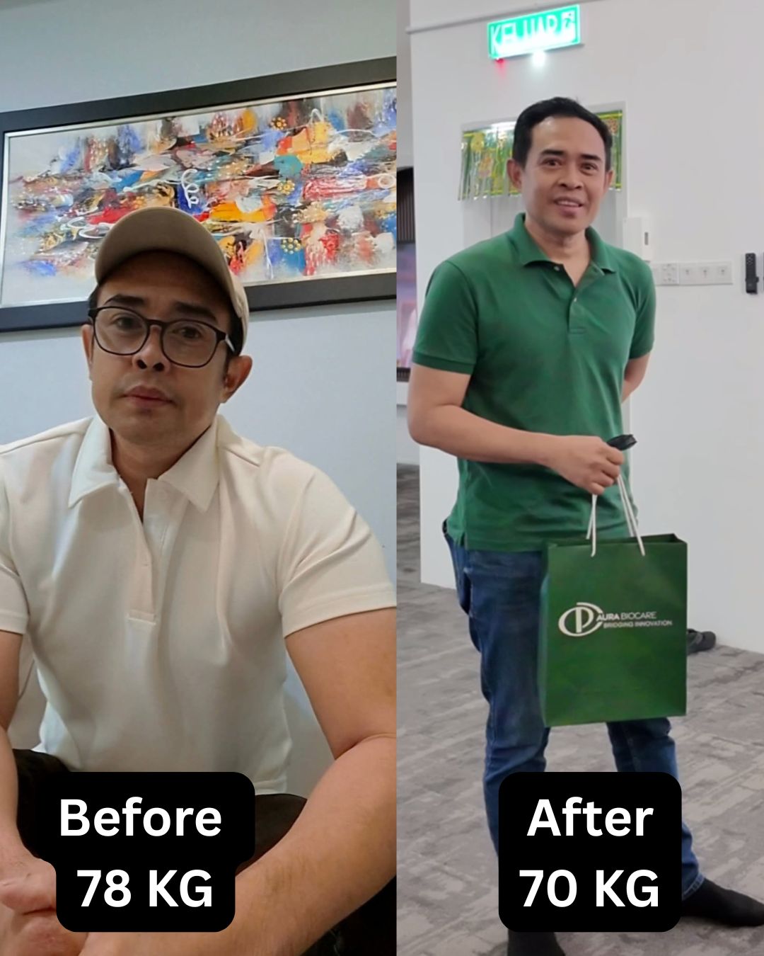 Before After 4