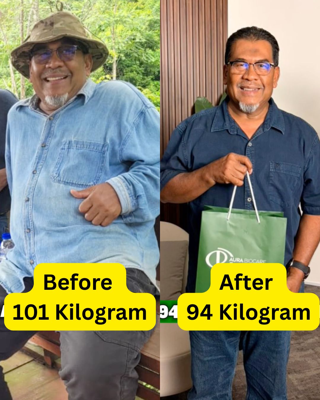 Before After 5