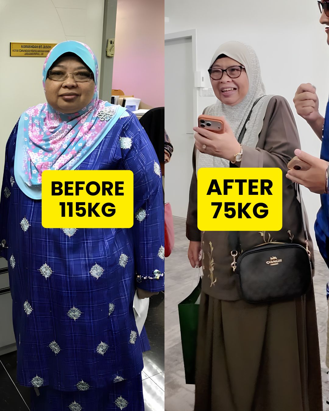 Before After
